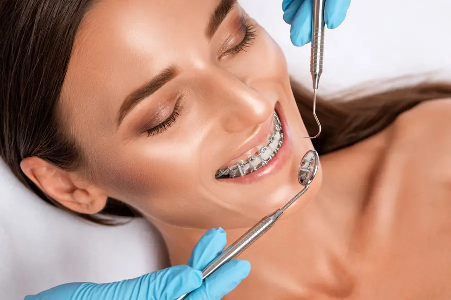 5 Myths About Adult Braces